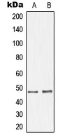 GHRHR Antibody - Western blot analysis of GHRH Receptor expression in SKNSH (A); LOVO (B) whole cell lysates.