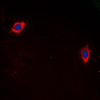 GHRHR Antibody - Immunofluorescent analysis of GHRH Receptor staining in LOVO cells. Formalin-fixed cells were permeabilized with 0.1% Triton X-100 in TBS for 5-10 minutes and blocked with 3% BSA-PBS for 30 minutes at room temperature. Cells were probed with the primary antibody in 3% BSA-PBS and incubated overnight at 4 C in a humidified chamber. Cells were washed with PBST and incubated with a DyLight 594-conjugated secondary antibody (red) in PBS at room temperature in the dark. DAPI was used to stain the cell nuclei (blue).