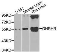 GHRHR Antibody - Western blot analysis of extracts of various cells.