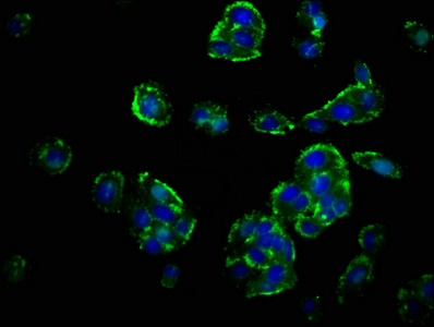 GHRHR Antibody - Immunofluorescence staining of HepG2 cells at a dilution of 1:67, counter-stained with DAPI. The cells were fixed in 4% formaldehyde, permeabilized using 0.2% Triton X-100 and blocked in 10% normal Goat Serum. The cells were then incubated with the antibody overnight at 4 °C.The secondary antibody was Alexa Fluor 488-congugated AffiniPure Goat Anti-Rabbit IgG (H+L) .
