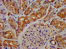 GHRHR Antibody - Immunohistochemistry image at a dilution of 1:200 and staining in paraffin-embedded human kidney tissue performed on a Leica BondTM system. After dewaxing and hydration, antigen retrieval was mediated by high pressure in a citrate buffer (pH 6.0) . Section was blocked with 10% normal goat serum 30min at RT. Then primary antibody (1% BSA) was incubated at 4 °C overnight. The primary is detected by a biotinylated secondary antibody and visualized using an HRP conjugated SP system.