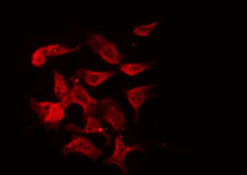 GHRHR Antibody - Staining LOVO cells by IF/ICC. The samples were fixed with PFA and permeabilized in 0.1% Triton X-100, then blocked in 10% serum for 45 min at 25°C. The primary antibody was diluted at 1:200 and incubated with the sample for 1 hour at 37°C. An Alexa Fluor 594 conjugated goat anti-rabbit IgG (H+L) Ab, diluted at 1/600, was used as the secondary antibody.