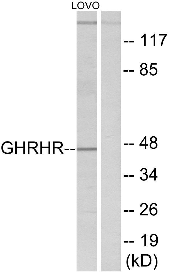 GHRHR Antibody - Western blot analysis of extracts from LOVO cells, using GHRHR antibody.