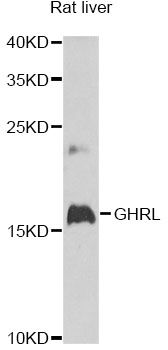 GHRL / Ghrelin Preproprotein Antibody - Western blot analysis of extracts of rat liver, using GHRL antibody at 1:1000 dilution. The secondary antibody used was an HRP Goat Anti-Rabbit IgG (H+L) at 1:10000 dilution. Lysates were loaded 25ug per lane and 3% nonfat dry milk in TBST was used for blocking. An ECL Kit was used for detection and the exposure time was 90s.