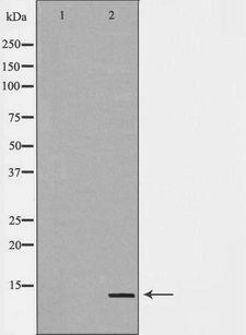 GHRL / Ghrelin Preproprotein Antibody - Western blot analysis of extracts of HeLa cells using GHRL antibody. The lane on the left is treated with the antigen-specific peptide.