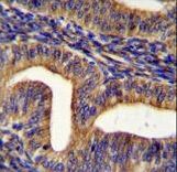GHSR / Ghrelin Receptor Antibody - GHSR Antibody immunohistochemistry of formalin-fixed and paraffin-embedded human uterus tissue followed by peroxidase-conjugated secondary antibody and DAB staining.