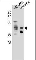 GHSR / Ghrelin Receptor Antibody - GHSR Antibody western blot of NCI-H292 cell line and mouse bladder tissue lysates (35 ug/lane). The GHSR antibody detected the GHSR protein (arrow).