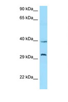 GHSR / Ghrelin Receptor Antibody - GHSR / Ghrelin Receptor antibody Western blot of Jurkat Cell lysate. Antibody concentration 1 ug/ml.  This image was taken for the unconjugated form of this product. Other forms have not been tested.