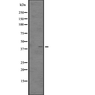 GHSR / Ghrelin Receptor Antibody - Western blot analysis of GHSR expression in A431 whole cells lysate. The lane on the left is treated with the antigen-specific peptide.