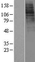 GHSR / Ghrelin Receptor Protein - Western validation with an anti-DDK antibody * L: Control HEK293 lysate R: Over-expression lysate