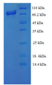 Endoribonuclease Dicer-Like Protein