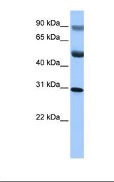GID4 Antibody - HepG2 cell lysate. Antibody concentration: 1.0 ug/ml. Gel concentration: 12%.  This image was taken for the unconjugated form of this product. Other forms have not been tested.