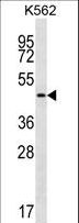 GIF / Intrinsic Factor Antibody - GIF Antibody western blot of K562 cell line lysates (35 ug/lane). The GIF antibody detected the GIF protein (arrow).