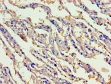 GIF / Intrinsic Factor Antibody - Immunohistochemistry of paraffin-embedded human lung tissue using antibody at 1:100 dilution.