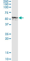 GIF / Intrinsic Factor Antibody - Immunoprecipitation of GIF transfected lysate using anti-GIF monoclonal antibody and Protein A Magnetic Bead, and immunoblotted with GIF rabbit polyclonal antibody.
