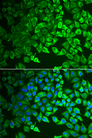 GIF / Intrinsic Factor Antibody - Immunofluorescence analysis of A549 cells.