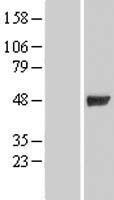 GIF / Intrinsic Factor Protein - Western validation with an anti-DDK antibody * L: Control HEK293 lysate R: Over-expression lysate