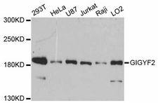 GIGYF2 Antibody - Western blot analysis of extracts of various cell lines, using GIGYF2 antibody at 1:3000 dilution. The secondary antibody used was an HRP Goat Anti-Rabbit IgG (H+L) at 1:10000 dilution. Lysates were loaded 25ug per lane and 3% nonfat dry milk in TBST was used for blocking. An ECL Kit was used for detection and the exposure time was 90s.
