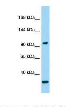 GIGYF2 Antibody - Western blot of COLO205. CTNNA3 antibody dilution 1.0 ug/ml.  This image was taken for the unconjugated form of this product. Other forms have not been tested.