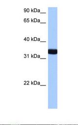 GIMAP1 Antibody - Hela cell lysate. Antibody concentration: 0.5 ug/ml. Gel concentration: 12%.  This image was taken for the unconjugated form of this product. Other forms have not been tested.