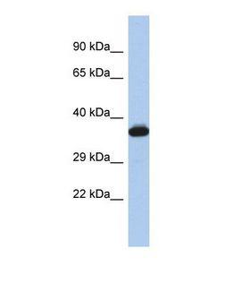 GIMAP2 Antibody - Western blot of Human Jurkat. GIMAP2 antibody dilution 1.0 ug/ml.  This image was taken for the unconjugated form of this product. Other forms have not been tested.