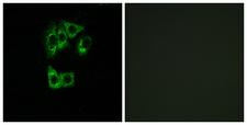 GIMAP2 Antibody - Immunofluorescence analysis of A549 cells, using GIMAP2 Antibody. The picture on the right is blocked with the synthesized peptide.