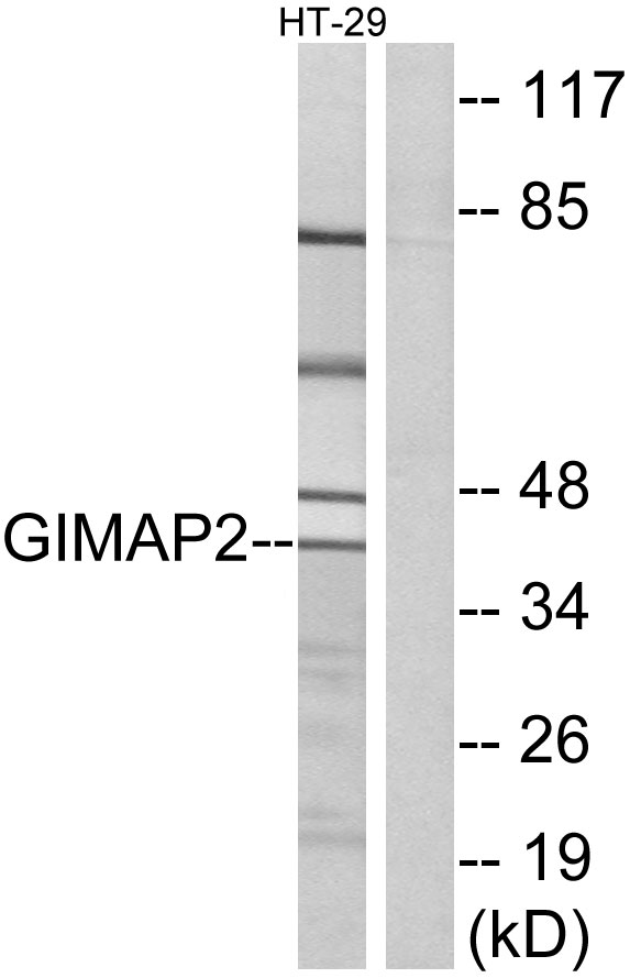 GIMAP2 Antibody - Western blot analysis of lysates from HT-29 cells, using GIMAP2 Antibody. The lane on the right is blocked with the synthesized peptide.