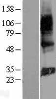 GIMAP2 Protein - Western validation with an anti-DDK antibody * L: Control HEK293 lysate R: Over-expression lysate