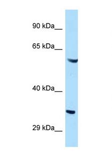 GIMAP4 Antibody - GIMAP4 antibody Western blot of HeLa Cell lysate. Antibody concentration 1 ug/ml.  This image was taken for the unconjugated form of this product. Other forms have not been tested.
