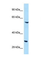 GIMAP4 Antibody - GIMAP4 antibody Western blot of HeLa Cell lysate. Antibody concentration 1 ug/ml.  This image was taken for the unconjugated form of this product. Other forms have not been tested.