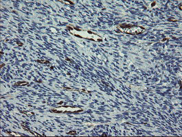 GIMAP4 Antibody - IHC of paraffin-embedded Human Ovary tissue using anti-GIMAP4 mouse monoclonal antibody.