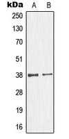 GIMAP4 Antibody - Western blot analysis of GIMAP4 expression in Jurkat (A); HeLa (B) whole cell lysates.