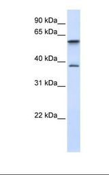 GIMAP5 Antibody - Placenta lysate. Antibody concentration: 1.0 ug/ml. Gel concentration: 12%.  This image was taken for the unconjugated form of this product. Other forms have not been tested.