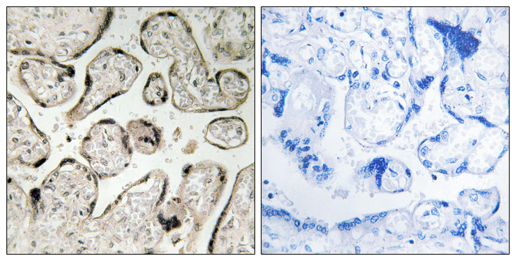 GIMAP5 Antibody - Immunohistochemistry analysis of paraffin-embedded human placenta tissue, using GIMAP5 Antibody. The picture on the right is blocked with the synthesized peptide.