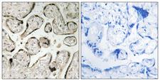 GIMAP5 Antibody - Immunohistochemistry analysis of paraffin-embedded human placenta tissue, using GIMAP5 Antibody. The picture on the right is blocked with the synthesized peptide.