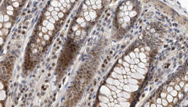 GIMAP5 Antibody - 1:100 staining rat colon tissue by IHC-P. The sample was formaldehyde fixed and a heat mediated antigen retrieval step in citrate buffer was performed. The sample was then blocked and incubated with the antibody for 1.5 hours at 22°C. An HRP conjugated goat anti-rabbit antibody was used as the secondary.