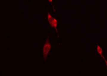 GIMAP5 Antibody - Staining HeLa cells by IF/ICC. The samples were fixed with PFA and permeabilized in 0.1% Triton X-100, then blocked in 10% serum for 45 min at 25°C. The primary antibody was diluted at 1:200 and incubated with the sample for 1 hour at 37°C. An Alexa Fluor 594 conjugated goat anti-rabbit IgG (H+L) Ab, diluted at 1/600, was used as the secondary antibody.