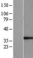 GIMAP5 Protein - Western validation with an anti-DDK antibody * L: Control HEK293 lysate R: Over-expression lysate