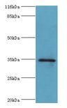 GIMAP7 Antibody - Western blot. All lanes: GIMAP7 antibody at 2 ug/ml+Jurkat whole cell lysate. Secondary antibody: Goat polyclonal to rabbit at 1:10000 dilution. Predicted band size: 35 kDa. Observed band size: 35 kDa.  This image was taken for the unconjugated form of this product. Other forms have not been tested.