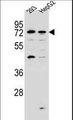 GIMAP8 Antibody - GIMAP8 Antibody western blot of 293,HepG2 cell line lysates (35 ug/lane). The GIMAP8 antibody detected the GIMAP8 protein (arrow).