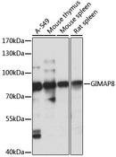 GIMAP8 Antibody - Western blot analysis of extracts of various cell lines, using GIMAP8 antibody at 1:1000 dilution. The secondary antibody used was an HRP Goat Anti-Rabbit IgG (H+L) at 1:10000 dilution. Lysates were loaded 25ug per lane and 3% nonfat dry milk in TBST was used for blocking. An ECL Kit was used for detection and the exposure time was 10s.