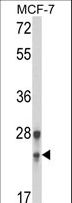 GINS1 / PSF1 Antibody - Western blot of GINS1 Antibody in MCF-7 cell line lysates (35 ug/lane). GINS1 (arrow) was detected using the purified antibody.