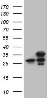 GINS3 Antibody - HEK293T cells were transfected with the pCMV6-ENTRY control. (Left lane) or pCMV6-ENTRY GINS3. (Right lane) cDNA for 48 hrs and lysed. Equivalent amounts of cell lysates. (5 ug per lane) were separated by SDS-PAGE and immunoblotted with anti-GINS3. (1:2000)