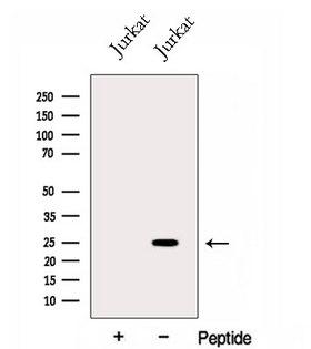 GINS3 Antibody - Western blot analysis of extracts of Jurkat cells using GINS3 antibody. The lane on the left was treated with blocking peptide.