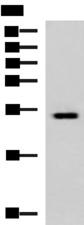 GINS3 Antibody - Western blot analysis of Hela cell lysate  using GINS3 Polyclonal Antibody at dilution of 1:800