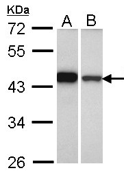 GIPC1 / GIPC Antibody - Sample (30 ug of whole cell lysate). A: A431 , B: Hela. 10% SDS PAGE. SEMCAP / GIPC antibody diluted at 1:1000.