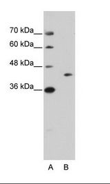 GIPC1 / GIPC Antibody - A: Marker, B: Jurkat Cell Lysate.  This image was taken for the unconjugated form of this product. Other forms have not been tested.