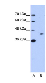 GIPC1 / GIPC Antibody - GIPC1 antibody Western blot of Jurkat lysate. This image was taken for the unconjugated form of this product. Other forms have not been tested.