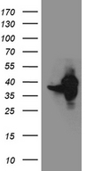 GIPC1 / GIPC Antibody - HEK293T cells were transfected with the pCMV6-ENTRY control. (Left lane) or pCMV6-ENTRY GIPC1. (Right lane) cDNA for 48 hrs and lysed