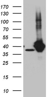 GIPC1 / GIPC Antibody - HEK293T cells were transfected with the pCMV6-ENTRY control. (Left lane) or pCMV6-ENTRY GIPC1. (Right lane) cDNA for 48 hrs and lysed